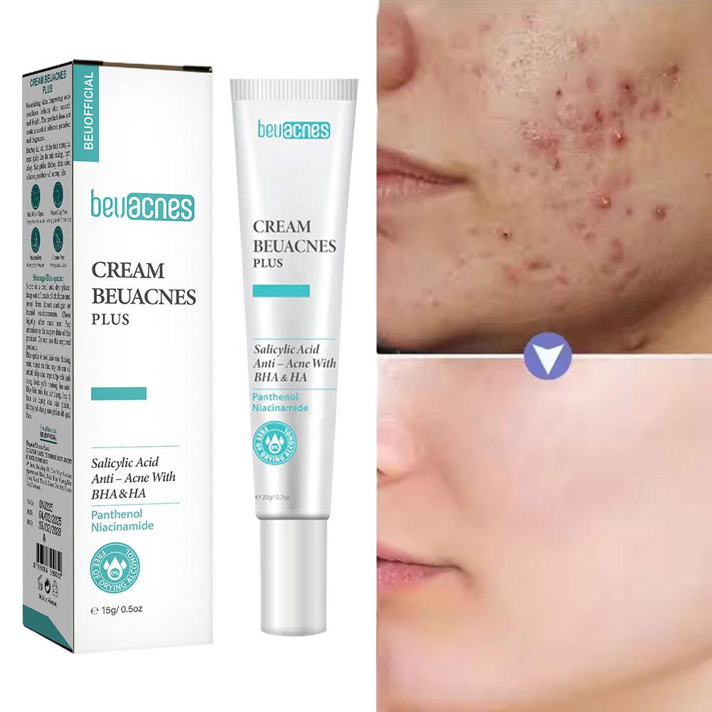 Skincare Niacinamide - Nuovo 20g Niacinamide Gel per l'acne