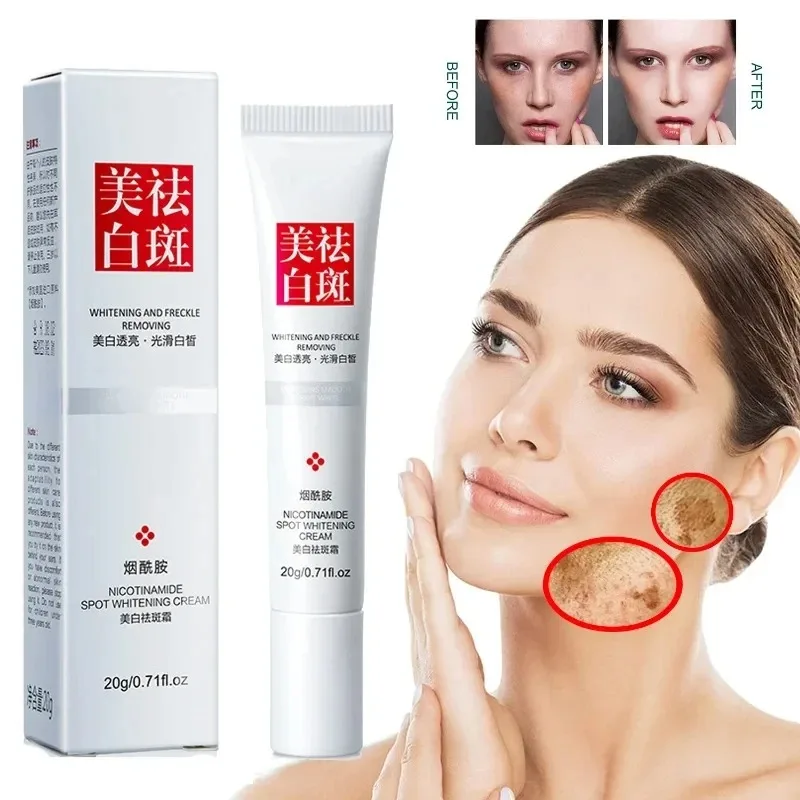 Skincare Niacinamide - Sbiadisce le lentiggini Macchie scure Crema