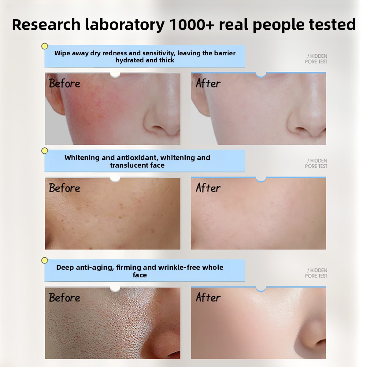 Crema Viso Ruyi con Vitamina E - Skincare Niacinamide recensione e prezzo