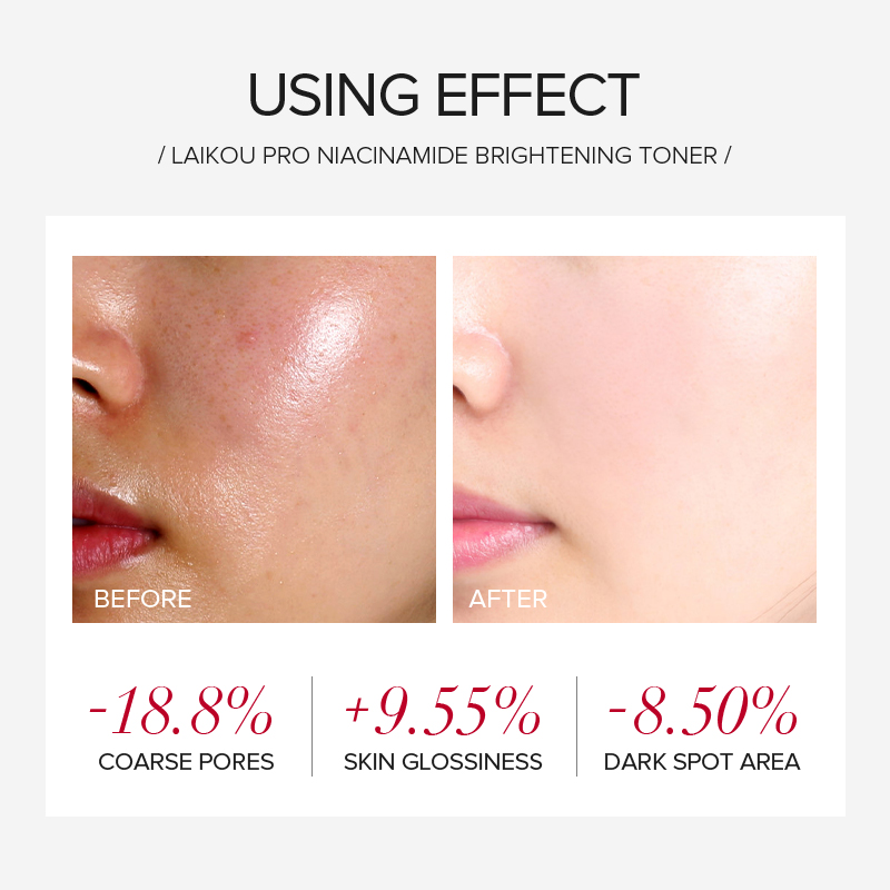 LAIKOU PRO Set di Cura della P - Skincare Niacinamide recensione e prezzo