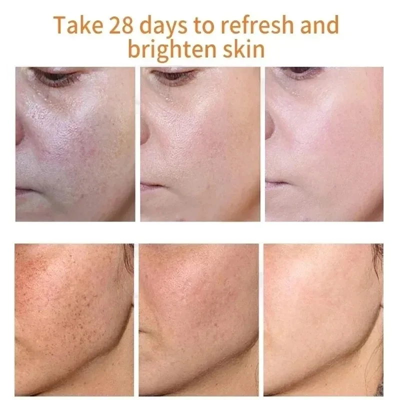 Sbiadisce le lentiggini Macchi - Skincare Niacinamide recensione e prezzo