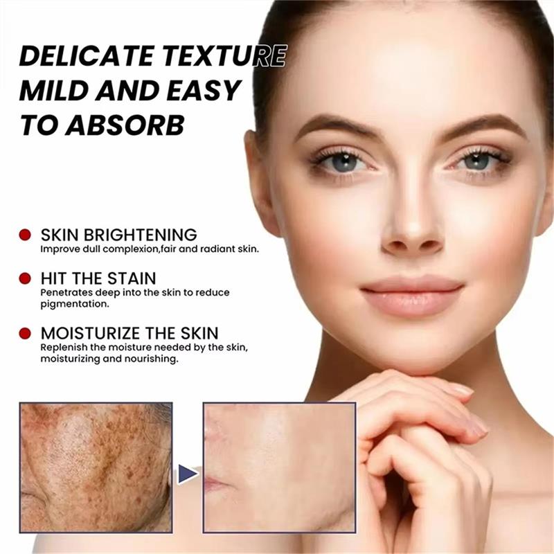 Crema Sbiancante Antimacchia,  - Skincare Niacinamide recensione e prezzo