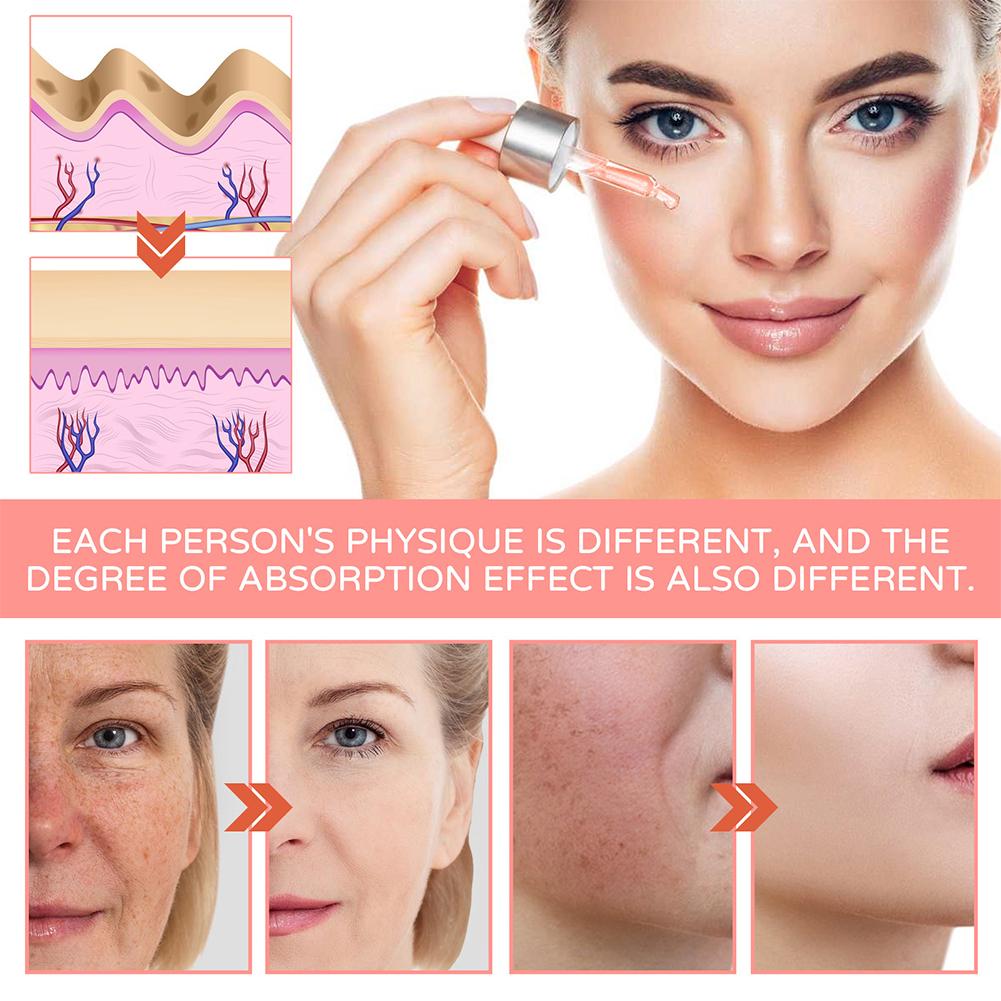 Siero Viso 5 in 1 con Acido Ia - Skincare Niacinamide recensione e prezzo